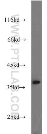 GNB1 Antibody in Western Blot (WB)