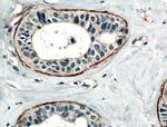 CD82 Antibody in Immunohistochemistry (Paraffin) (IHC (P))
