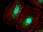COPS6 Antibody in Immunocytochemistry (ICC/IF)