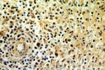 STAT6 Antibody in Immunohistochemistry (Paraffin) (IHC (P))