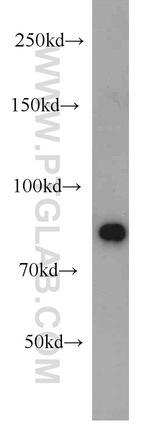 STAT6 Antibody in Western Blot (WB)