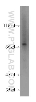 STAT6 Antibody in Western Blot (WB)