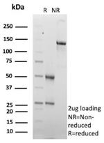 ABCC4/ATP Binding Cassette Subfamily C Member 4 (Drug Target) Antibody in SDS-PAGE (SDS-PAGE)