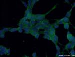 TES Antibody in Immunocytochemistry (ICC/IF)