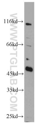 TES Antibody in Western Blot (WB)