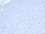p21WAF1 (Tumor Suppressor Protein) Recombinant Mouse Monoclonal Antibody (rCIP1/6907)