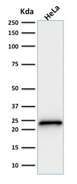 p21WAF1 (Tumor Suppressor Protein) Antibody in Western Blot (WB)