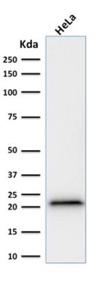 p21WAF1 (Tumor Suppressor Protein) Antibody in Western Blot (WB)