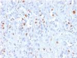 p21WAF1 (Tumor Suppressor Protein) Antibody in Immunohistochemistry (Paraffin) (IHC (P))