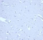 p21WAF1 (Tumor Suppressor Protein) Antibody in Immunohistochemistry (Paraffin) (IHC (P))