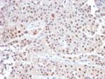 p21WAF1 (Tumor Suppressor Protein) Recombinant Rabbit Monoclonal Antibody (CIP1/2489R)