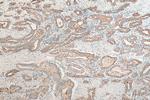 IL11RA Antibody in Immunohistochemistry (Paraffin) (IHC (P))