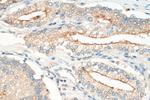 IL11RA Antibody in Immunohistochemistry (Paraffin) (IHC (P))