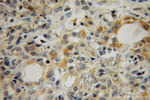 MEA1 Antibody in Immunohistochemistry (Paraffin) (IHC (P))