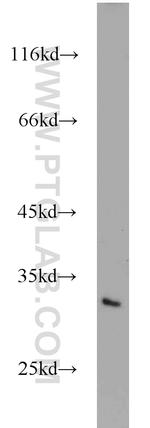 MEA1 Antibody in Western Blot (WB)