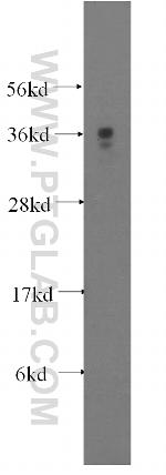 MEA1 Antibody in Western Blot (WB)