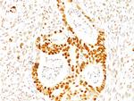 p27Kip1 (Mitotic Inhibitor/Suppressor Protein) Antibody in Immunohistochemistry (Paraffin) (IHC (P))