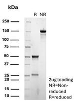 p27Kip1 (Mitotic Inhibitor/Suppressor Protein) Antibody in SDS-PAGE (SDS-PAGE)