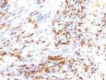 p27Kip1 (Mitotic Inhibitor/Suppressor Protein) Monoclonal Antibody (DCS-72.F6, KIP1/769)