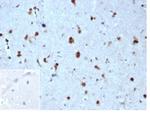 p27Kip1 (Mitotic Inhibitor/Suppressor Protein) Antibody in Immunohistochemistry (Paraffin) (IHC (P))