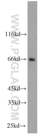 FAF1 Antibody in Western Blot (WB)