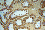 p19 INK4d Antibody in Immunohistochemistry (Paraffin) (IHC (P))