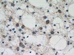 TAU Antibody in Immunohistochemistry (Paraffin) (IHC (P))