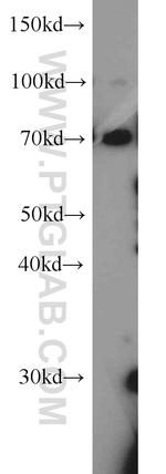 TAU Antibody in Western Blot (WB)