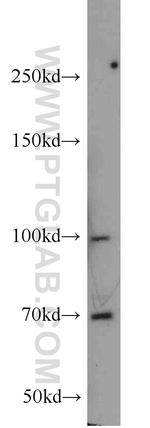 TAU Antibody in Western Blot (WB)