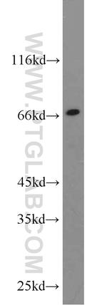 TAU Antibody in Western Blot (WB)