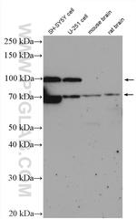 TAU Antibody in Western Blot (WB)