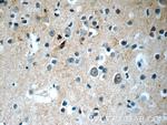 SNX17 Antibody in Immunohistochemistry (Paraffin) (IHC (P))