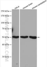 SNX17 Antibody in Western Blot (WB)