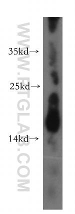GADD45G Antibody in Western Blot (WB)