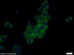 TRAPB/SSR2 Antibody in Immunocytochemistry (ICC/IF)