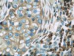 TRAPB/SSR2 Antibody in Immunohistochemistry (Paraffin) (IHC (P))