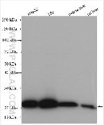 TRAPB/SSR2 Antibody in Western Blot (WB)