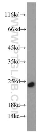 TRAPB/SSR2 Antibody in Western Blot (WB)