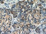 TRAPB/SSR2 Antibody in Immunohistochemistry (Paraffin) (IHC (P))