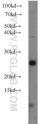 TRAPB/SSR2 Antibody in Western Blot (WB)