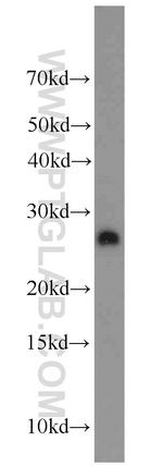 TRAPB/SSR2 Antibody in Western Blot (WB)