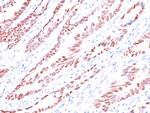 p57Kip2 (Mitotic Inhibitor/Suppressor Protein) Monoclonal Antibody (KP10)