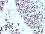 p57Kip2 (Mitotic Inhibitor/Suppressor Protein) Monoclonal Antibody (KIP2/8572)