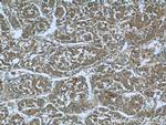 MAGEC2 Antibody in Immunohistochemistry (Paraffin) (IHC (P))