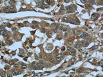 MAGEC2 Antibody in Immunohistochemistry (Paraffin) (IHC (P))