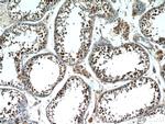 MAGEC2 Antibody in Immunohistochemistry (Paraffin) (IHC (P))