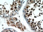 MAGEC2 Antibody in Immunohistochemistry (Paraffin) (IHC (P))