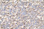 MAGEC2 Antibody in Immunohistochemistry (Paraffin) (IHC (P))