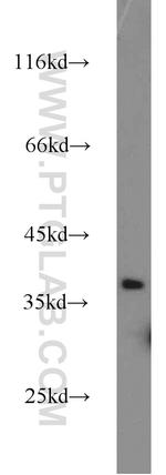 MAGEC2 Antibody in Western Blot (WB)