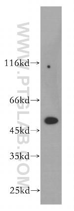 POLD2 Antibody in Western Blot (WB)